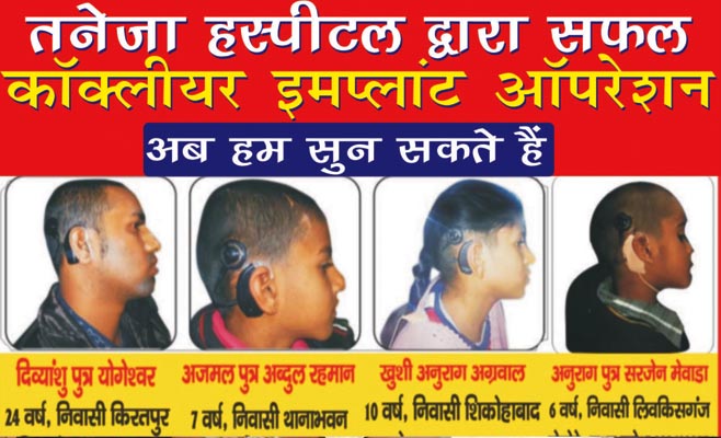 Cochlear Implant
