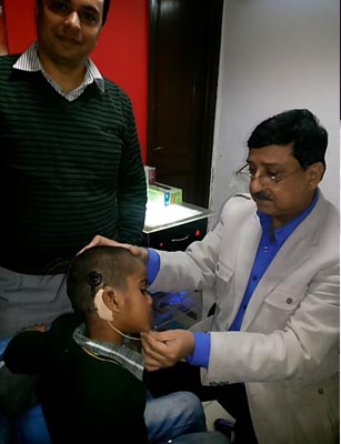 Cochlear Implant